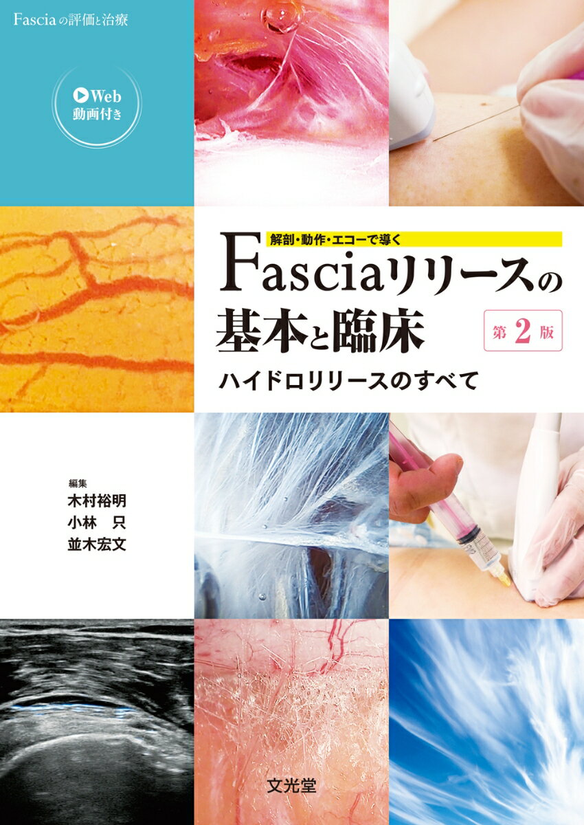 解剖・動作・エコーで導くFasciaリリースの基本と臨床 第2版　-ハイドロリリースのすべてー Fasciaの評価と治療 [ 木村裕明 ]