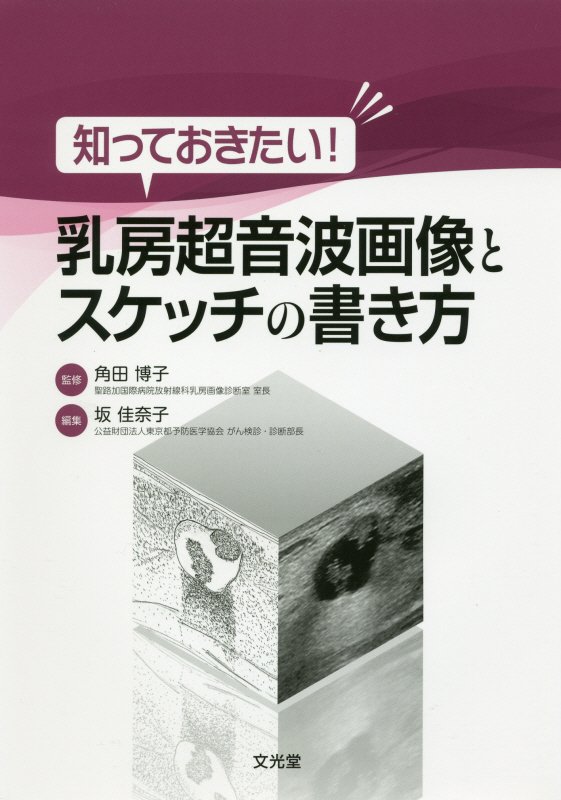 知っておきたい！乳房超音波画像とスケッチの書き方