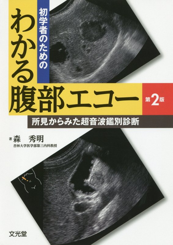 初学者のためのわかる腹部エコー第2版 所見からみた超音波鑑別診断 [ 森秀明 ]