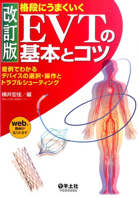 格段にうまくいくEVTの基本とコツ改訂版