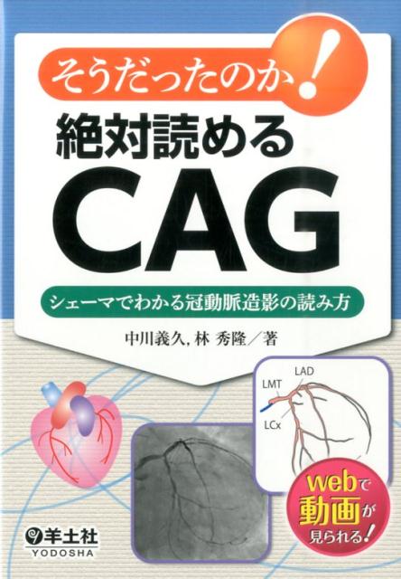 そうだったのか！絶対読めるCAG