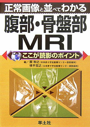 正常画像と並べてわかる腹部・骨盤部MRI