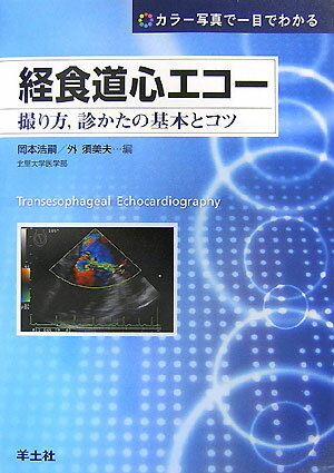 経食道心エコー 撮り方，診かたの基本とコツ [ 岡本浩嗣 ]