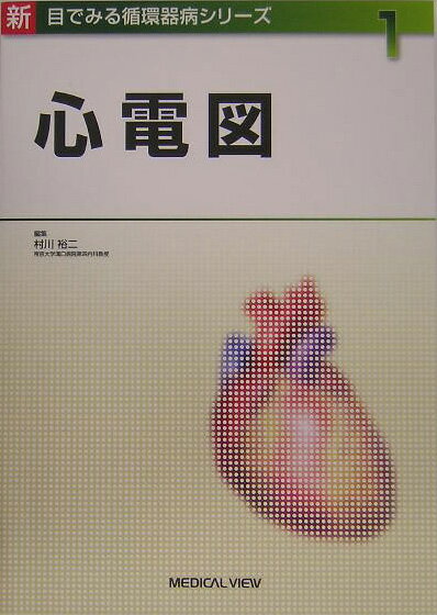 心電図