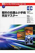眼科の処置と小手術完全マスタ-