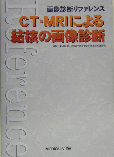 CT・MRIによる結核の画像診断