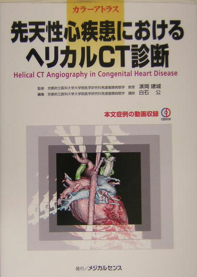 先天性心疾患におけるヘリカルCT診断
