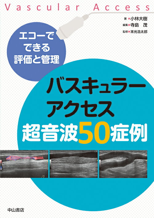 ＶＡ超音波検査の基本と実践を５０の症例から学ぶ！