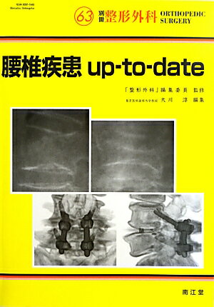 腰椎疾患up-to-date （別冊整形外科） [ 大川淳 ]