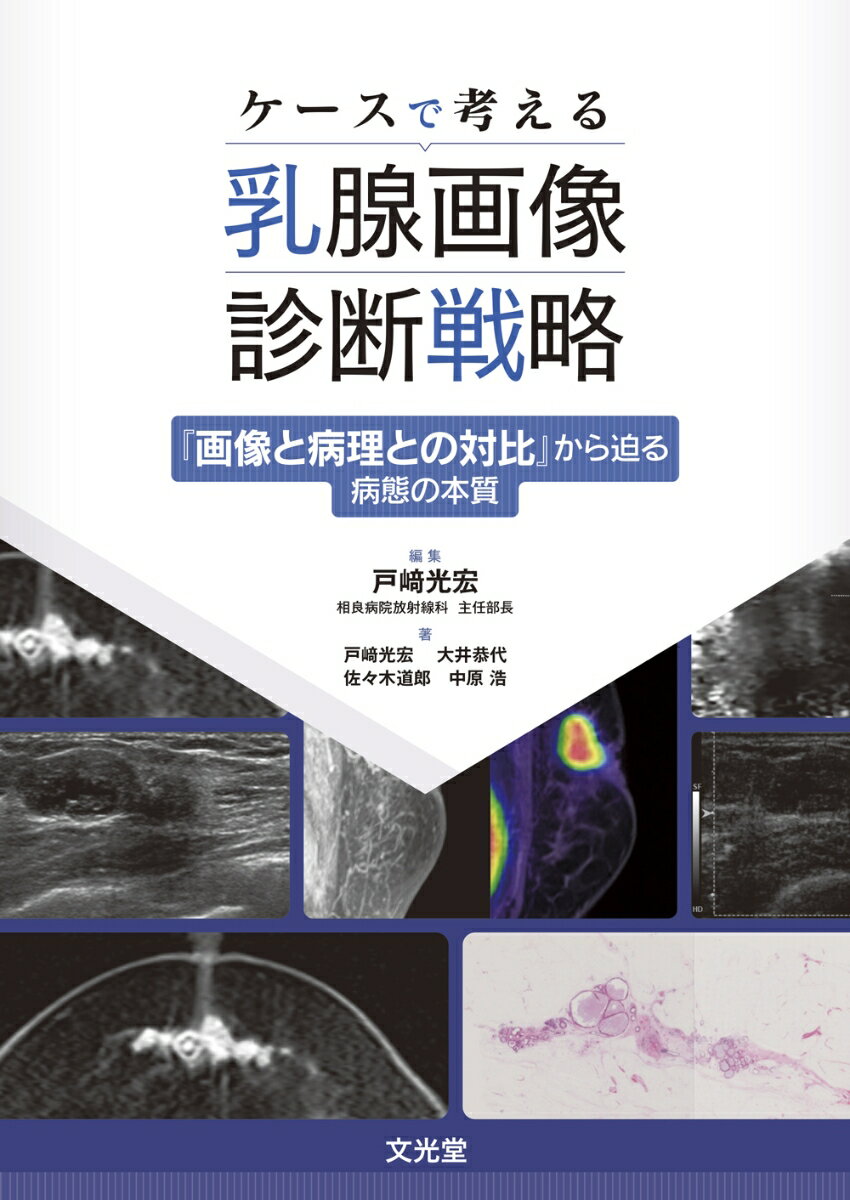 ケースで考える乳腺画像診断戦略 画像と病理との対比 から迫る病態の本質 [ 戸崎光宏 ]