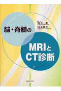 脳・脊髄のMRIとCT診断