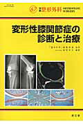 変形性膝関節症の診断と治療