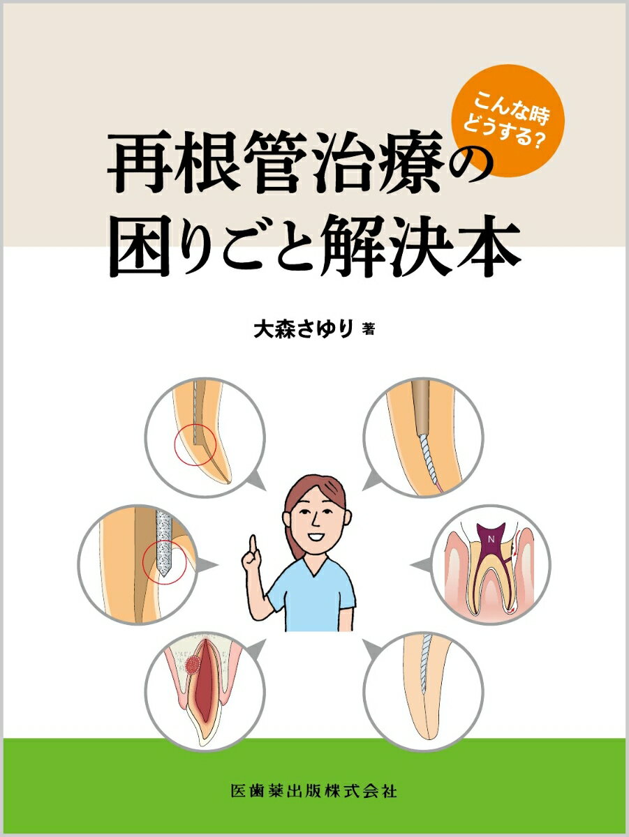 こんな時どうする？ 再根管治療の困りごと解決本