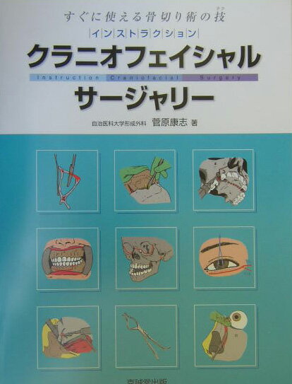 インストラクション・クラニオフェイシャル・サージャリー