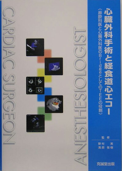 心臓外科手術と経食道心エコー