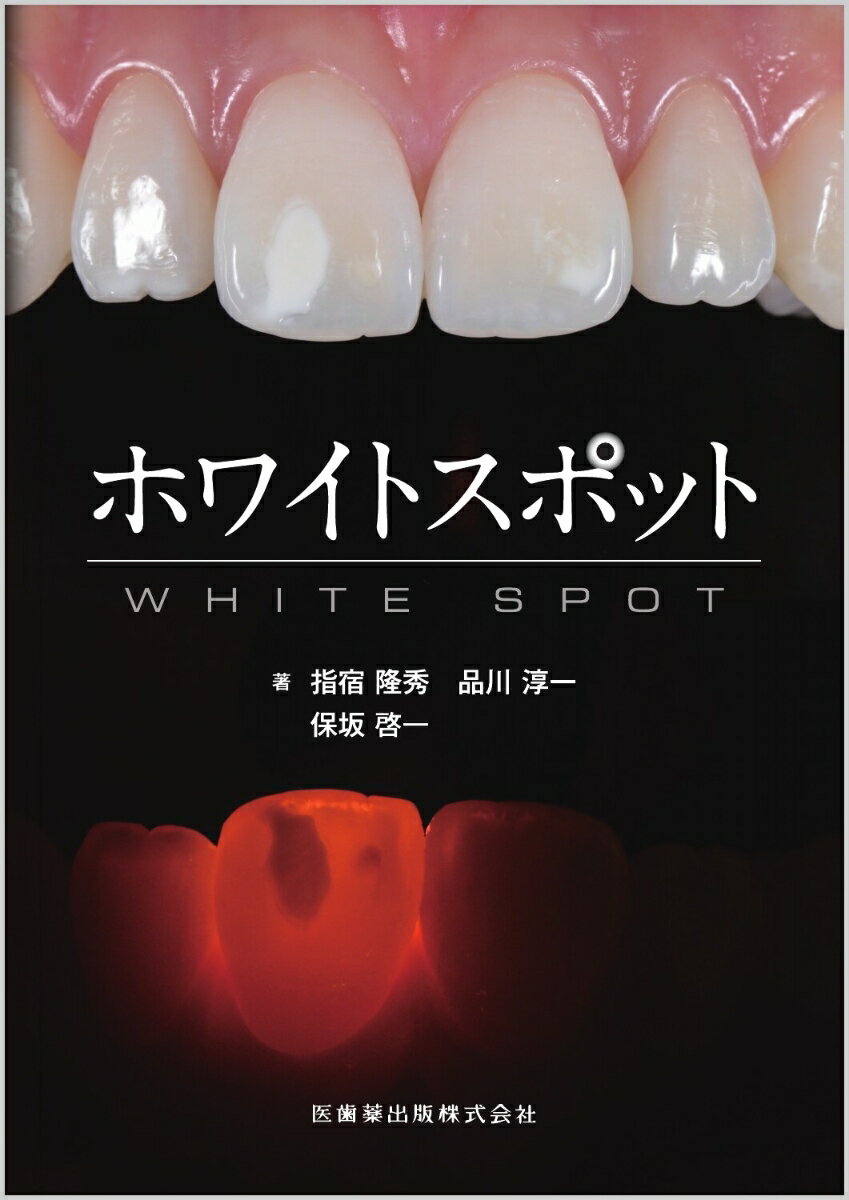 ホワイトスポット [ 指宿 隆秀 ]...