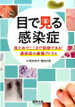 『目で見た診断ポイント』が凝縮！診断確定に必須の『病歴・身体所見・検査』も解説！感染症を“素早く確実に”診断できる力がつく！