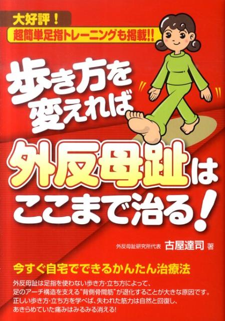 歩き方を変えれば外反母趾はここまで治る！