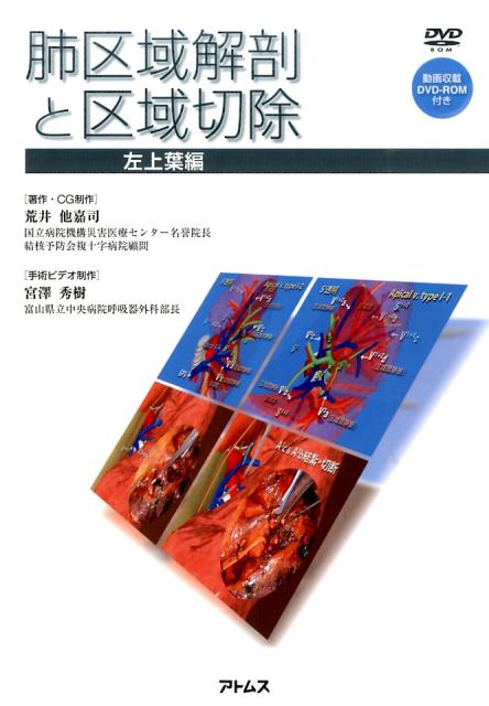 肺区域解剖と区域切除（左上葉編）