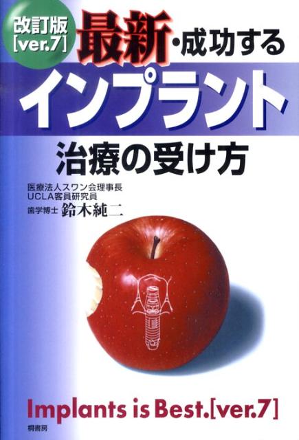 最新・成功するインプラント治療の受け方　改訂版