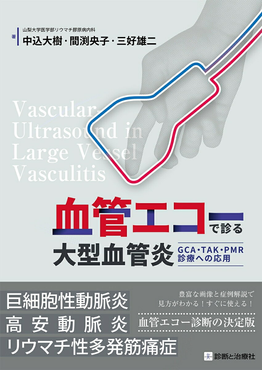 血管エコーで診る大型血管炎 / 中込　大樹・間渕　央子・三好　雄二 (診断と治療社) の書影
