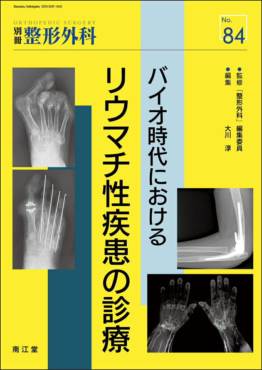 バイオ時代におけるリウマチ性疾患の診療 （別冊整形外科 84） [ 大川淳 ]