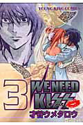 We need kiss（3）