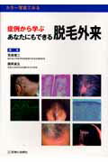 症例から学ぶあなたにもできる脱毛外来