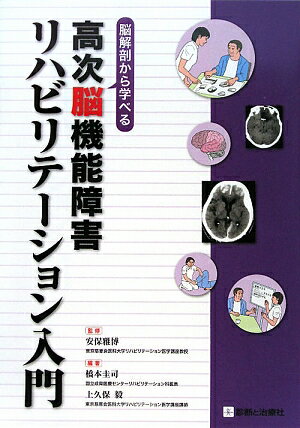 高次脳機能障害リハビリテーション入門