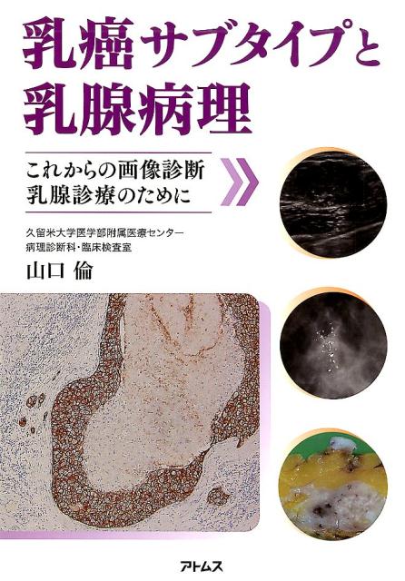 乳癌サブタイプと乳腺病理