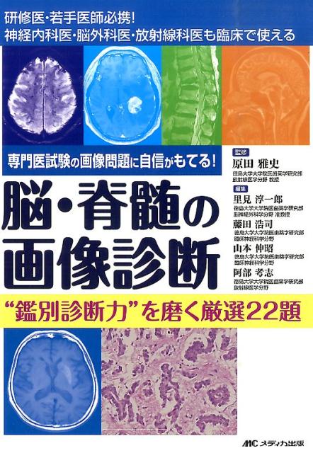 脳・脊髄の画像診断 “鑑別診断力”を磨く厳選22題