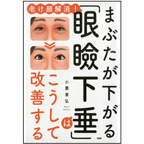 まぶたが下がる「眼瞼下垂」はこうして改善する