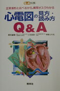 心電図の見方・読み方Q＆A