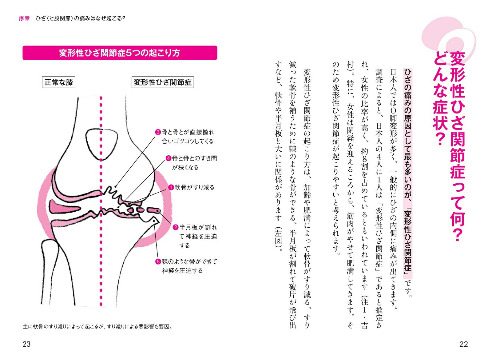 1日半分のアボカドでひざの痛みはラクになる [...の紹介画像3