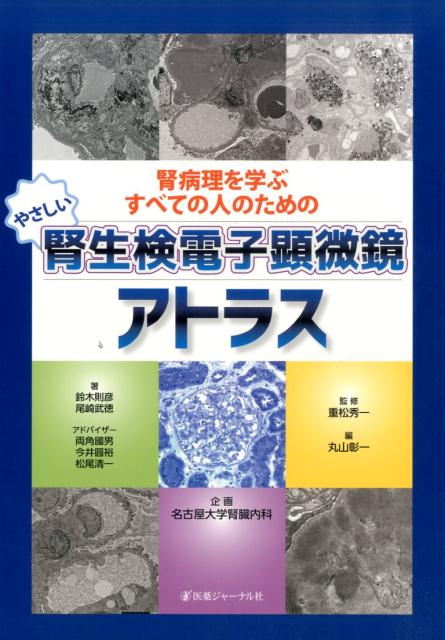 腎病理を学ぶすべての人のためのやさしい腎生検電子顕微鏡アトラ