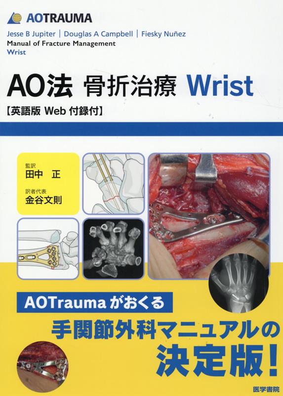 AO法骨折治療 Wrist