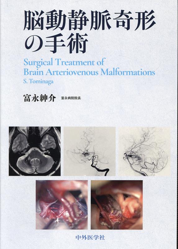 脳動静脈奇形の手術 [ 富永紳介 ]