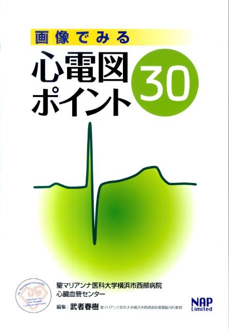 画像でみる心電図ポイント30