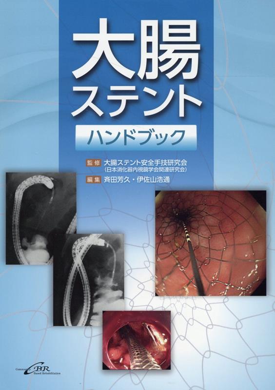 大腸ステントの基本から応用まで、臨床の現場で役立つ情報満載！「総説」では大腸ステントの種類、適応症、手技の流れなど、基本的な概要、大腸ステントに関する情報提供、エビデンスを習得するための基盤。「症例」では実際の症例を通して、安全な手技のための大腸ステントの使用法とコツを詳細に解説する。