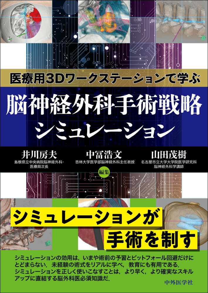 医療用3Dワークステーションで学ぶ 脳神経外科手術戦略シミュレーション