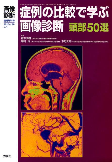 症例の比較で学ぶ画像診断頭部50選