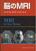 脳のMRI