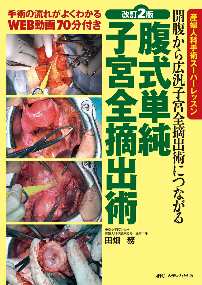 2015年刊行の『広汎子宮全摘術につながる腹式単純子宮全摘術』に開腹を加えた待望の改訂版。広汎子宮全摘術を意識した拡大子宮全摘の手術手順を、手術器具の持ち方など詳細にこだわって、高画質の写真と動画で解説。