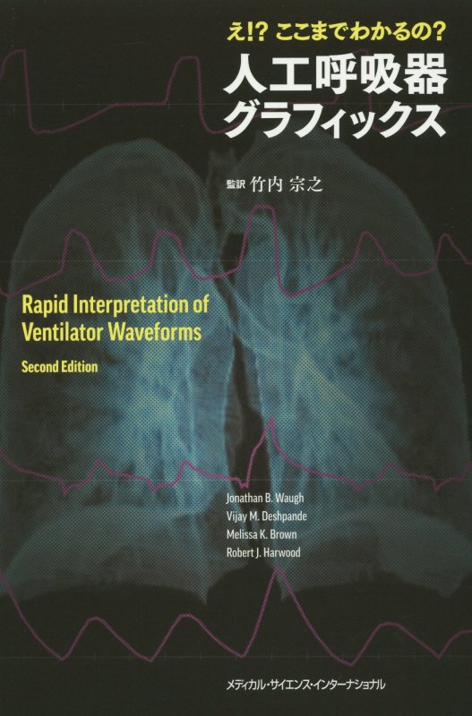 モニターに潜むサインを見逃さない！波形を正確に読み解き、より安全な呼吸管理へ。米国の呼吸療法士が贈る豊富なグラフィックで学べる波形解釈の入門書。