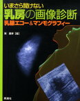 いまさら聞けない乳房の画像診断 乳腺エコー＆マンモグラフィー [ 東義孝 ]