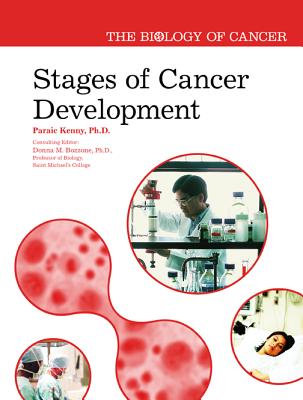 Stages of Cancer Development STAGES OF CANCER DEVELOPMENT （Biology of Cancer） [ Paraic Kenny ]