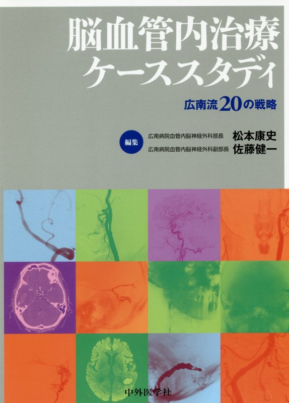 脳血管内治療ケーススタディ