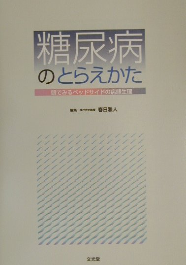 糖尿病のとらえかた