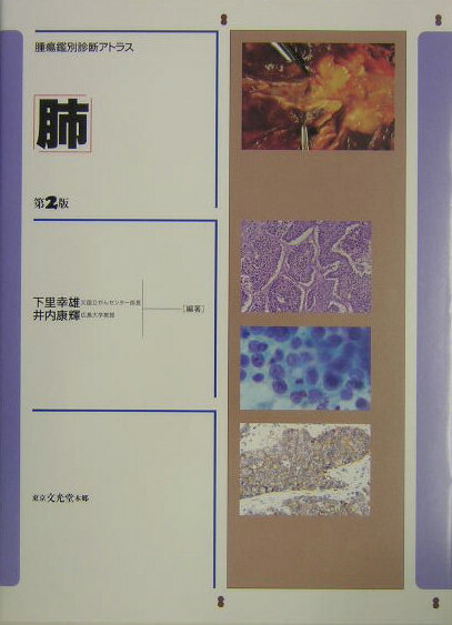 腫瘍鑑別診断アトラス第2版