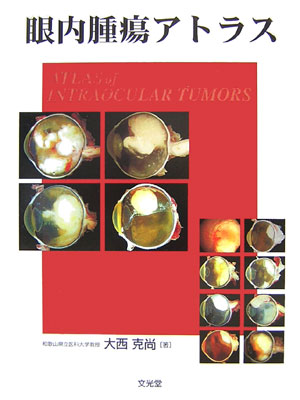 眼内腫瘍アトラス